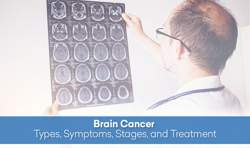 Brain Cancer - Types, Symptoms, Stages, and Treatment